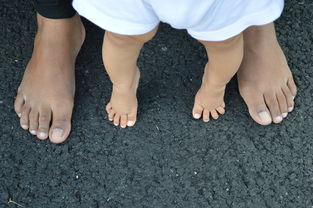 孕妇肚脐眼凸出来是怎么回事